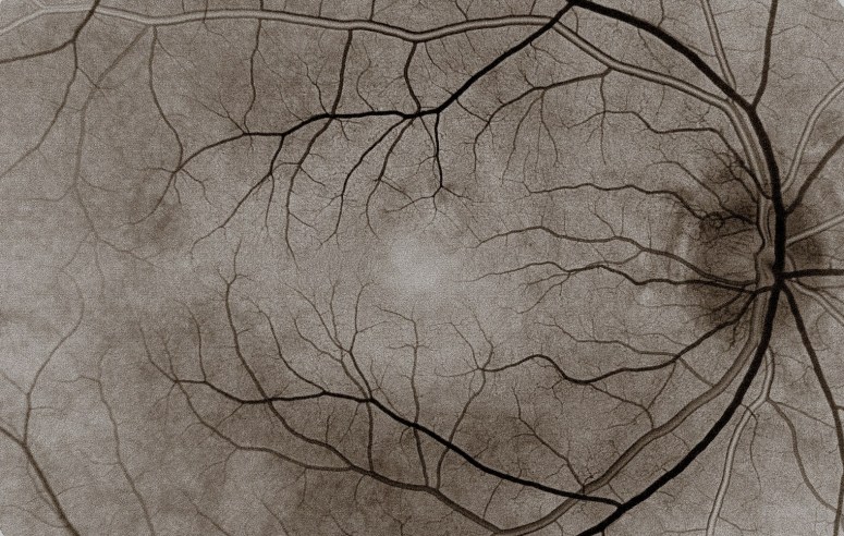 desmettre_Londres_Oph